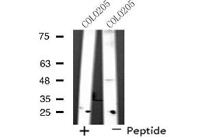 Image no. 2 for anti-Synaptotagmin XI (SYT11) (Internal Region) antibody (ABIN6257650)