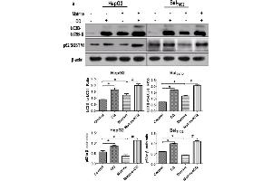 Image no. 6 for anti-Sequestosome 1 (SQSTM1) (AA 51-150) antibody (ABIN682153)