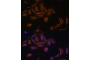 RPL7A antibody  (AA 1-266)