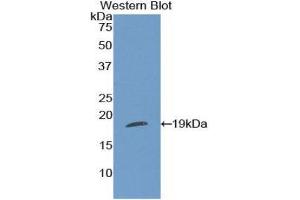 Image no. 1 for anti-Thrombospondin 1 (THBS1) (AA 511-670) antibody (ABIN1860743)