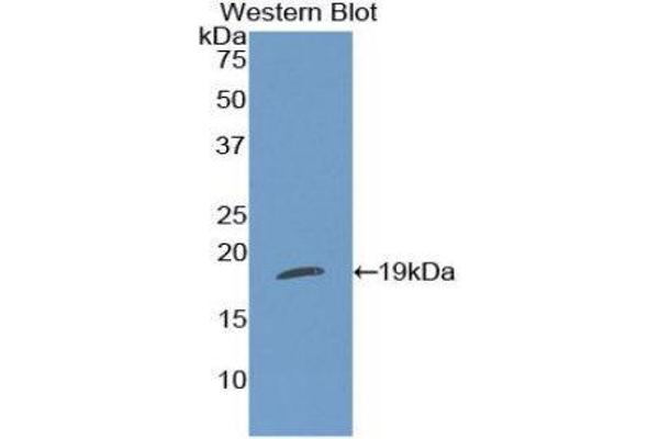 anti-Thrombospondin 1 (THBS1) (AA 511-670) antibody