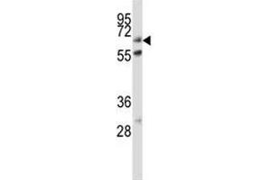 Image no. 3 for anti-Alkaline Phosphatase (ALP) (AA 282-309) antibody (ABIN3029910)