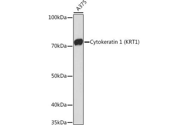 Cytokeratin 1 抗体