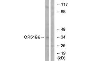 anti-Olfactory Receptor, Family 51, Subfamily B, Member 6 (OR51B6) (AA 66-115) antibody
