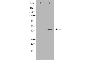 NR1I3 antibody  (Internal Region)