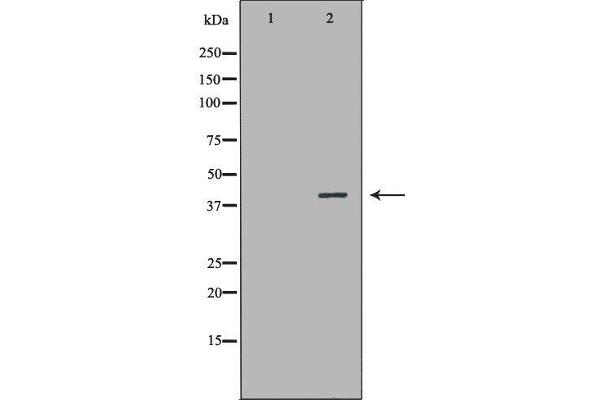 NR1I3 antibody  (Internal Region)