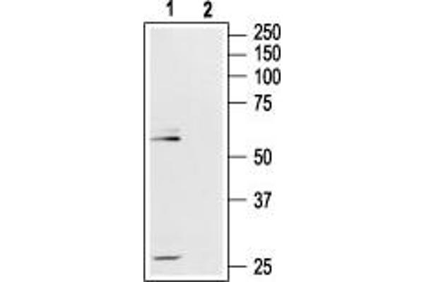 Mu Opioid Receptor 1 antibody  (Extracellular, N-Term)