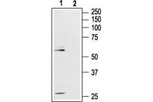 Mu Opioid Receptor 1 antibody  (Extracellular, N-Term)