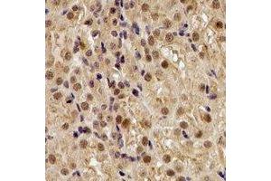 Image no. 2 for anti-Alveolar Soft Part Sarcoma Chromosome Region, Candidate 1 (ASPSCR1) antibody (ABIN2967121)