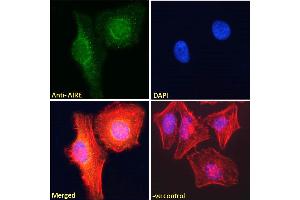 Image no. 7 for anti-Autoimmune Regulator (AIRE) (C-Term) antibody (ABIN184780)