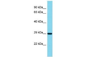 Image no. 1 for anti-Interleukin-1 Receptor-Associated Kinase 1 Binding Protein 1 (IRAK1BP1) (C-Term) antibody (ABIN2789204)