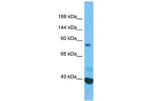 Image no. 1 for anti-Scm-Like with Four Mbt Domains 1 (SFMBT1) (Middle Region) antibody (ABIN2784173)