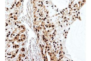 anti-SET Nuclear Oncogene (SET) (N-Term) antibody