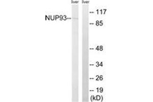 Image no. 1 for anti-Nucleoporin 93kDa (NUP93) (AA 221-270) antibody (ABIN1535117)