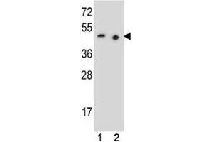 Image no. 2 for anti-Paired Box 9 (PAX9) (AA 69-95) antibody (ABIN3032137)