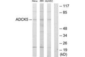 Image no. 1 for anti-AarF Domain Containing Kinase 5 (ADCK5) (AA 151-200) antibody (ABIN1533942)