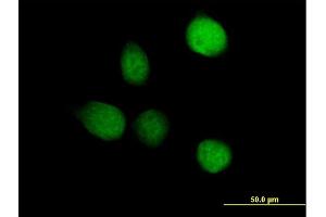 Immunofluorescence of purified MaxPab antibody to TSEN2 on HeLa cell.