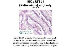 Image no. 1 for anti-Regulator of Telomere Elongation Helicase 1 (RTEL1) antibody (ABIN1738970)