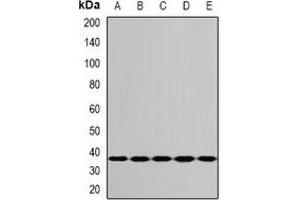 Image no. 3 for anti-Ribosomal Protein S3A (RPS3A) antibody (ABIN3198299)
