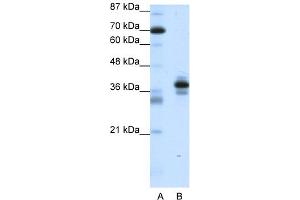 Image no. 1 for anti-Paired-Like Homeodomain 1 (PITX1) (C-Term) antibody (ABIN2780442)