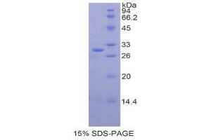 Image no. 1 for Cathepsin C (CTSC) (AA 231-463) protein (His tag) (ABIN1877900)
