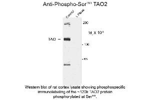 Image no. 1 for anti-TAO Kinase 2 (TAOK2) (pSer181) antibody (ABIN6656508)