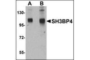 Image no. 2 for anti-SH3-Domain Binding Protein 4 (SH3BP4) (C-Term) antibody (ABIN500704)