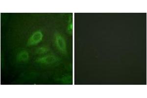 Immunofluorescence analysis of HeLa cells, using DRP-2 (Phospho-Thr514) Antibody.