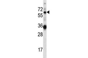 Image no. 2 for anti-GATA Zinc Finger Domain Containing 2B (GATAD2B) (AA 1-30) antibody (ABIN3028678)