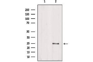 Image no. 2 for anti-Phosphatidylinositol Glycan F (PIGF) (Internal Region) antibody (ABIN6264205)