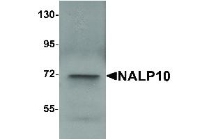 Image no. 1 for anti-NLR Family, Pyrin Domain Containing 10 (NLRP10) (N-Term) antibody (ABIN6655446)