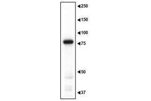 Image no. 4 for anti-Melanoma Antigen Family D, 1 (MAGED1) (AA 1-775) antibody (ABIN2452045)