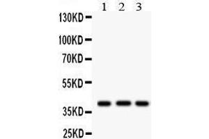Image no. 1 for anti-Major Histocompatibility Complex, Class I, A (HLA-A) (AA 82-106), (N-Term) antibody (ABIN3043842)