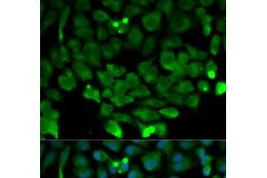 Immunofluorescence analysis of HeLa cells using CUL3 Polyclonal Antibody