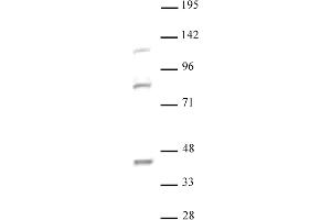 SSRP1 antibody (pAb) tested by Western blot.