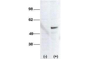 Image no. 2 for anti-serine/threonine Kinase 38 Like (STK38L) (C-Term) antibody (ABIN360006)