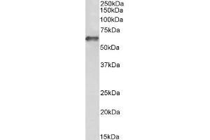 Image no. 2 for anti-Intercellular Adhesion Molecule 1 (ICAM1) (AA 313-327) antibody (ABIN2613438)