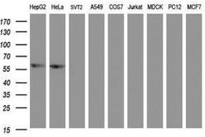 Image no. 5 for anti-Adrenocortical Dysplasia Homolog (ACD) antibody (ABIN1496406)