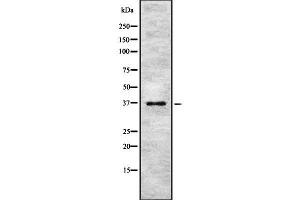 Image no. 1 for anti-PIN2/TERF1 Interacting, Telomerase Inhibitor 1 (PINX1) (Internal Region) antibody (ABIN6264227)