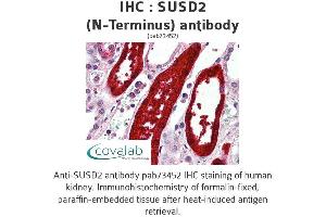 Image no. 1 for anti-Sushi Domain Containing 2 (SUSD2) (N-Term) antibody (ABIN1739807)