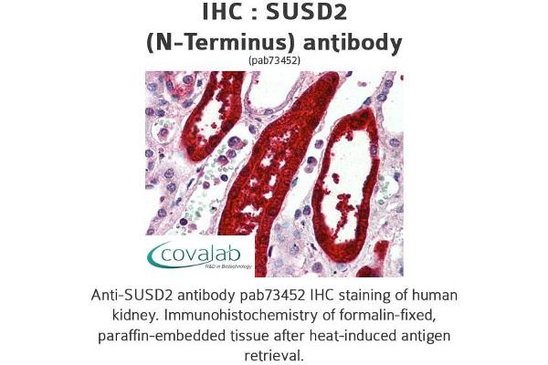 SUSD2 antibody  (N-Term)