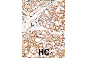 Immunohistochemistry (IHC) image for anti-BCL2-Related Ovarian Killer (BOK) (BH3 Domain) antibody (ABIN2159579)