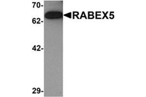 Image no. 1 for anti-RAB Guanine Nucleotide Exchange Factor (GEF) 1 (RABGEF1) (Center) antibody (ABIN783421)
