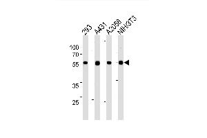 Image no. 1 for anti-Transmembrane phosphoinositide 3-Phosphatase and Tensin Homolog 2 (TPTE2) antibody (ABIN1882284)