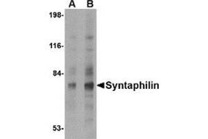 Image no. 2 for anti-Syntaphilin (SNPH) (N-Term) antibody (ABIN500851)
