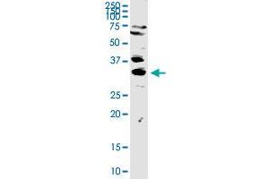 Image no. 6 for anti-three Prime Repair Exonuclease 1 (TREX1) (AA 1-369) antibody (ABIN524703)