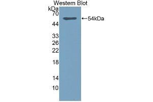 anti-Sialic Acid Acetylesterase (SIAE) antibody (Biotin)