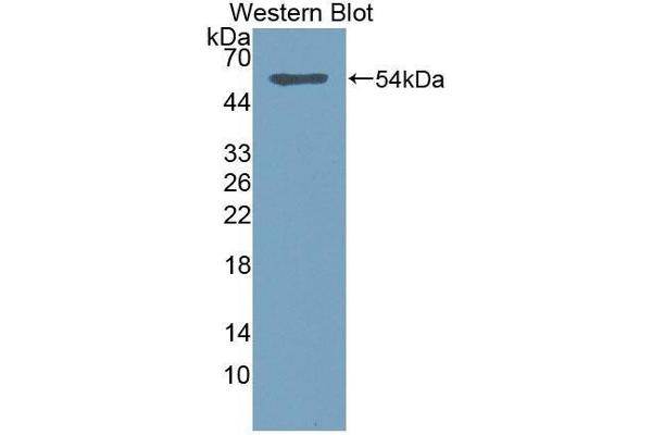 anti-Sialic Acid Acetylesterase (SIAE) antibody (Biotin)