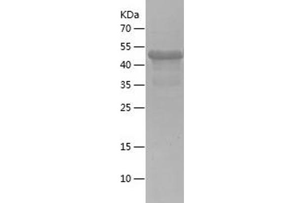 PABP Protein (AA 2-235) (His-IF2DI Tag)