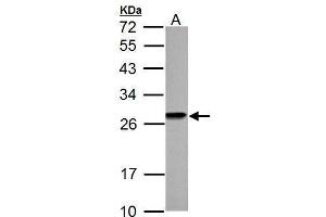 Image no. 10 for anti-High Mobility Group Box 1 (HMGB1) (Center) antibody (ABIN2854997)